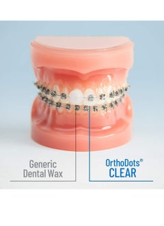 Orvance OrthoDots CLEAR – Moisture Activated Braces Wax Alternative for Pain Caused by Braces, Clear Aligner Trays, and Other Orthodontic Appliances. OrthoDots Stick Better and Stay on Longer than Dental Wax.  - Image 2