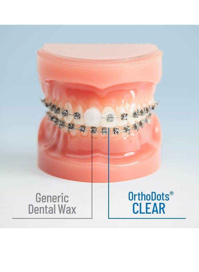 Orvance OrthoDots CLEAR – Moisture Activated Braces Wax Alternative for Pain Caused by Braces, Clear Aligner Trays, and Other Orthodontic Appliances. OrthoDots Stick Better and Stay on Longer than Dental Wax.  - Image 2
