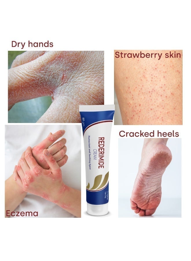 UBM Skincare Bundle -Rederimide 10% Urea Cream & Instamax Panthenol Cream- For Irritated Skin,Cracked Heels, Strawberry Skin, Pigments & Exfoliation. - Image 3