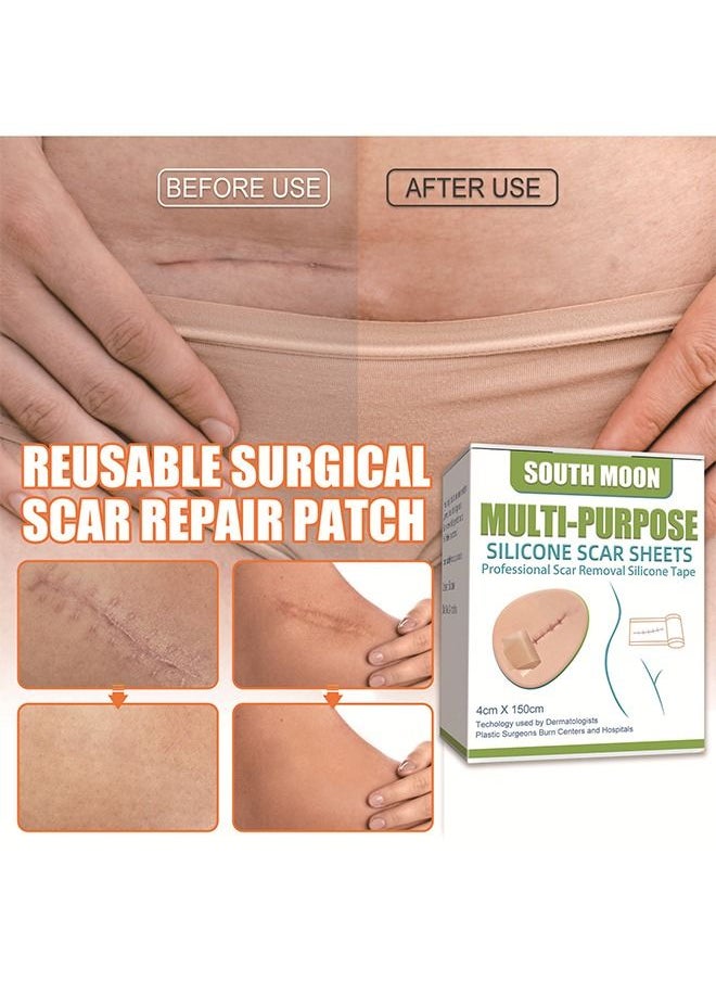 SOUTH MOON - Silicone Scar Sheets - Extra Long Scar Sheets for C-Section, Tummy Tuck, Keloid, and Surgical Scars - Reusable Medical Grade Silicone Scar Sheets - Post Surgery Supplies - Image 1