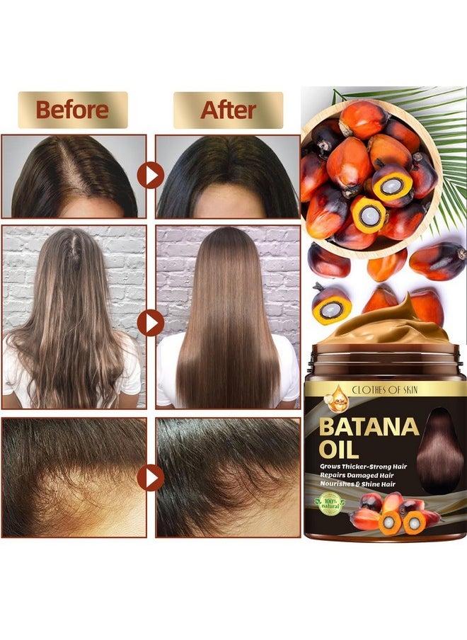 Clothes of skin Batana Oil and 2 Pack Ginger Hair Regrowth Shampoo Bar,Natural Raw Batana Oil for Hair Growth Hair Mask Ginger Bar Shampoo,Promotes Hair Growth,Nourishes Scalp,Repair & Strengthen Dry Damaged Hair  - Image 2