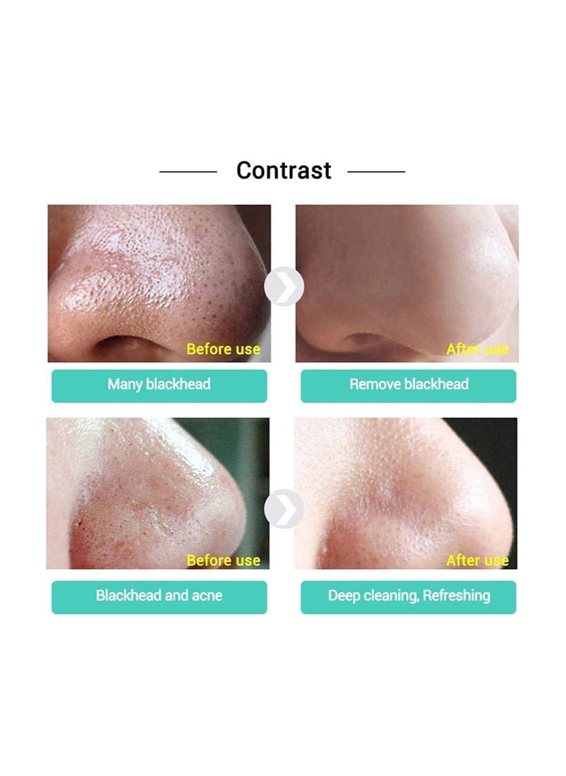 LANBENA Blackhead Remover Peel Off Nose Mask  - Image 5