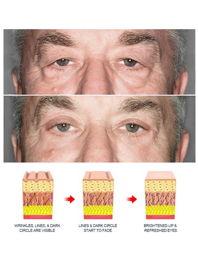 إيست مون كريم كول تندر للعين للرجال 15 جم - كريم ريتينول للعين لإصلاح أكياس العين والهالات السوداء وشد الخطوط الدقيقة وترطيب وإصلاح كريم العين - Image 4