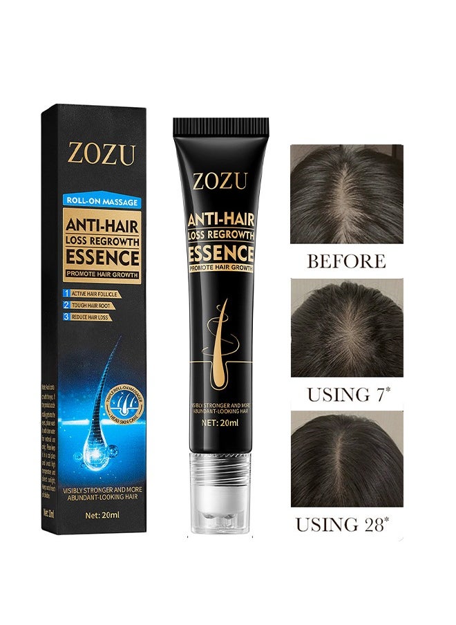 Zozu Anti Hair Loss Regrowth Essence,Hair Boost Strengthen Essence，Promote Hair Circulation Visibly Stronger And More Abundant Looking Hair,Scalp Massage Roller For Hair Loss Treatments, Aids against Hair-thining, Hair Regrowth Treatment-20ML  - Image 1
