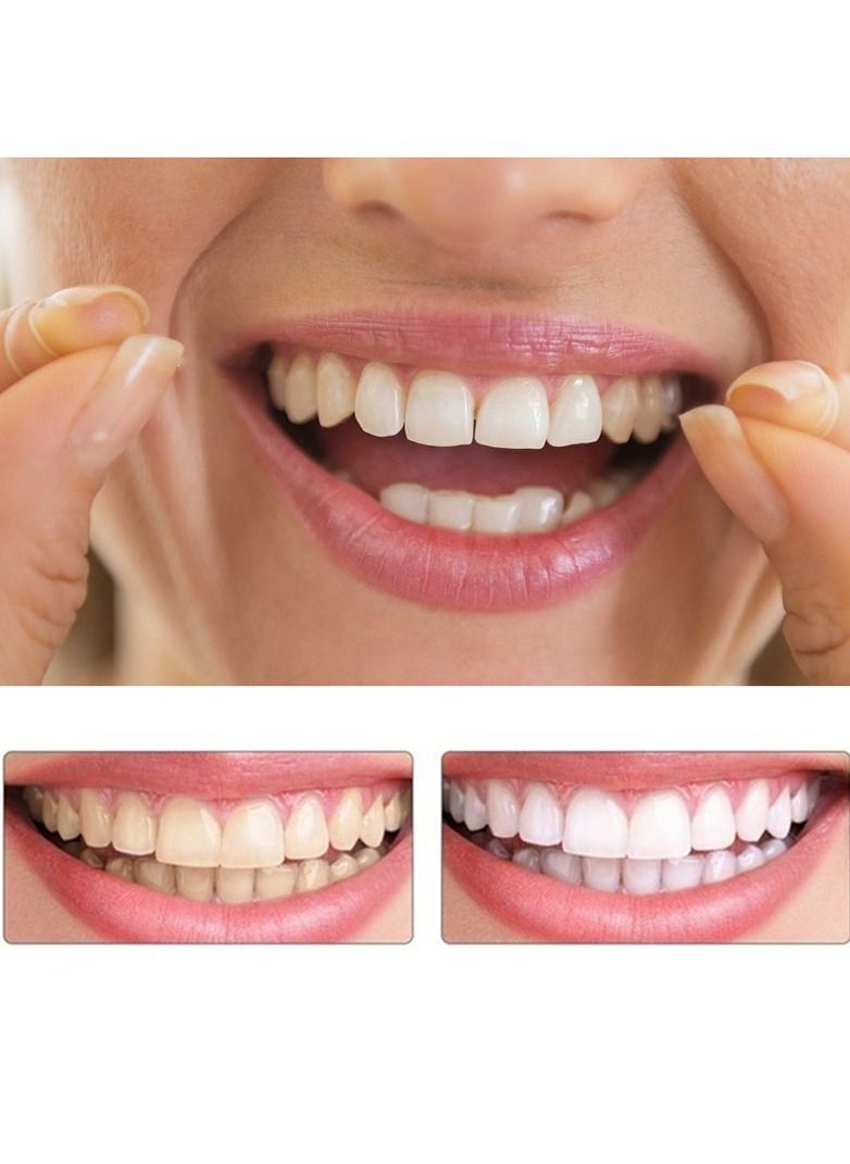 SNAP Teeth Veneers Anti-true Braces Snap On Smile Teeth Whitening Denture Teeth Comfortable Veneer Cover Teeth  - Image 5