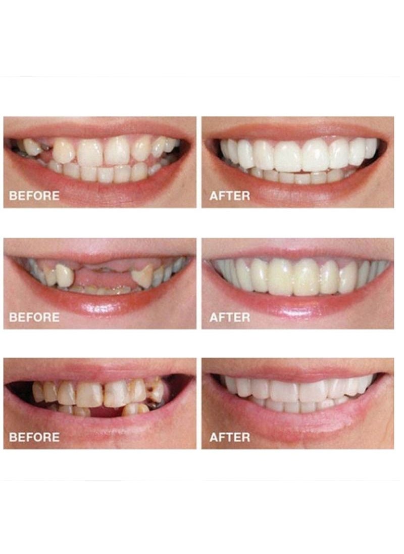 SNAP Teeth Veneers Anti-true Braces Snap On Smile Teeth Whitening Denture Teeth Comfortable Veneer Cover Teeth  - Image 3