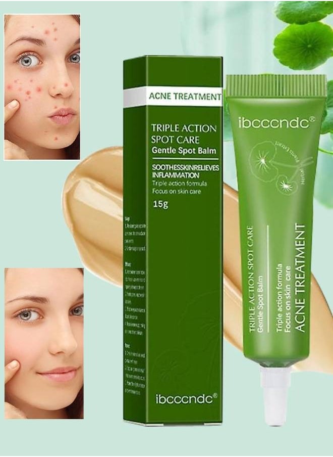 ibcccndc Acne Treatment Balm for Face Advanced Gel Acne Scar Spot Treatment for Face Gentle Skin Care for Acne Prone Skin Back Acne Treatment Shrink Pores Soothes Redness Non sticky 15g  - Image 1
