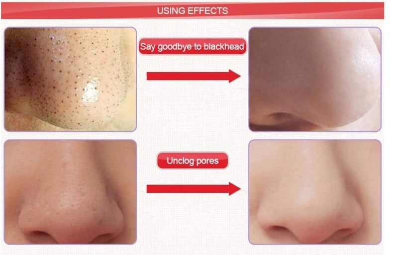 Cameleon Nose Pore and Blackhead Removel Strips, 10 Strips - Image 5