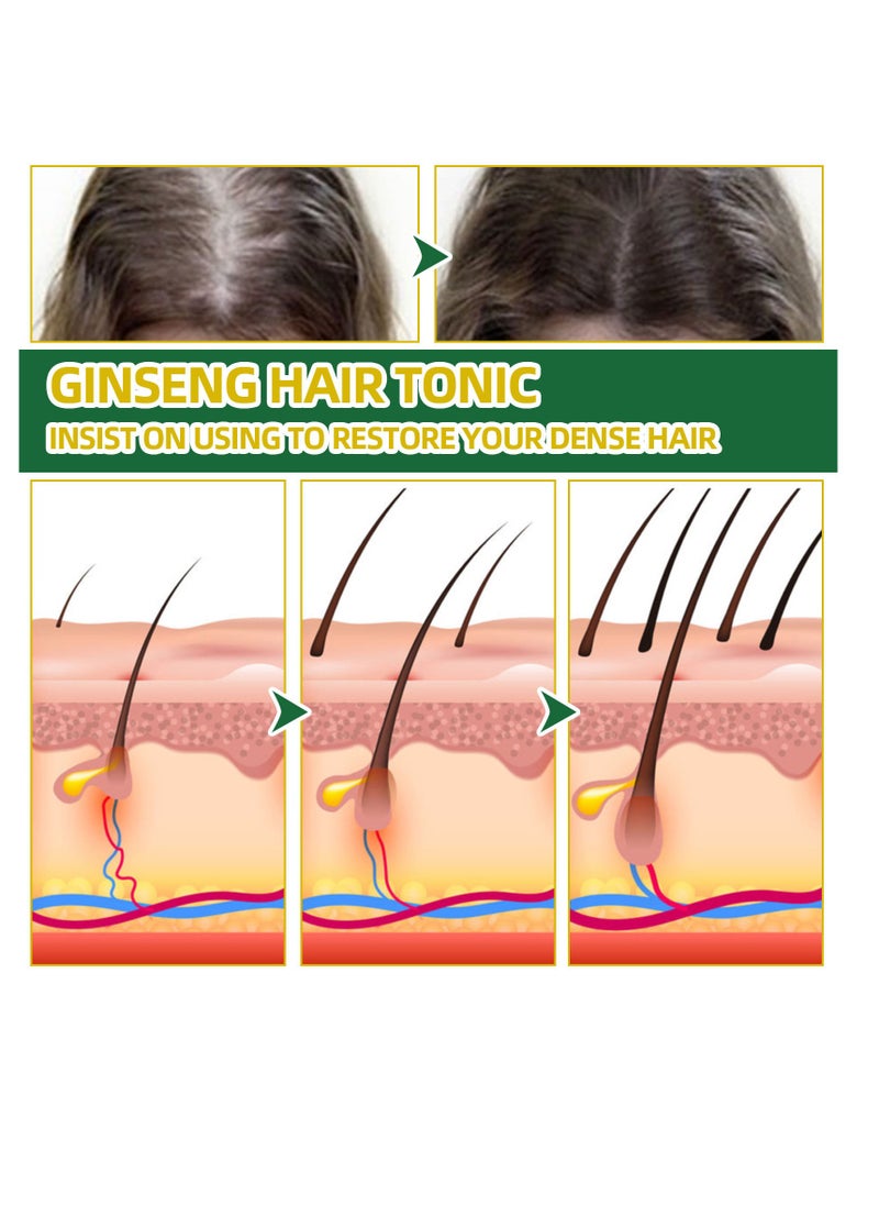 OUHOE - Ginseng Hair Regeneration Spray, Rapid Growth Hair Treatment, Hair Growth Serum Essence Oil Regrow, For Women And Men 100ML - Image 1