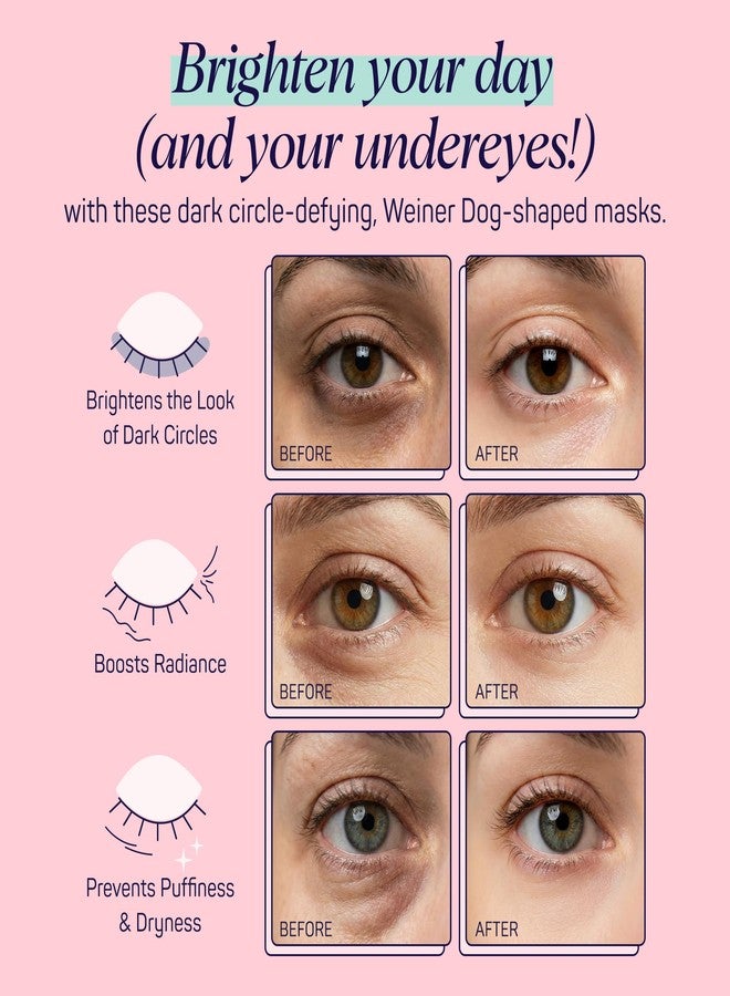 SpaLife So Fetch Hydrogel Under Eye Patches for Dark Circles | Dachshund Under Eye Patches for Puffy Eyes | Weiner Dog Undereye Bags and Puffiness Removal | Bachelorette Party Favors | 8 Pairs - Image 5