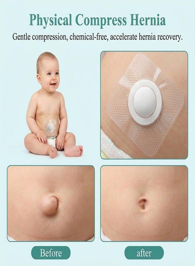 JFRHUDS 15Pcs Baby Belly Navel Patches,Umbilical Hernia Patch with Pads - Image 5