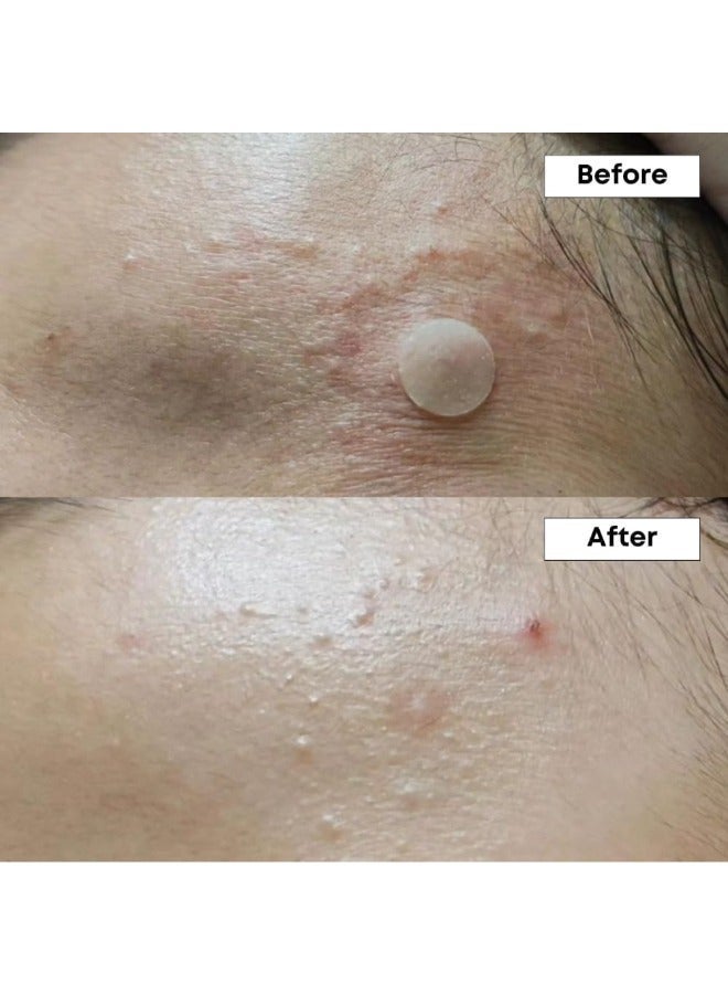 NINELESS مصل NINELESS A-Control 10% Azelaic Acid - علاج حب الشباب وتفتيح البشرة وموازنة لونها - Image 3