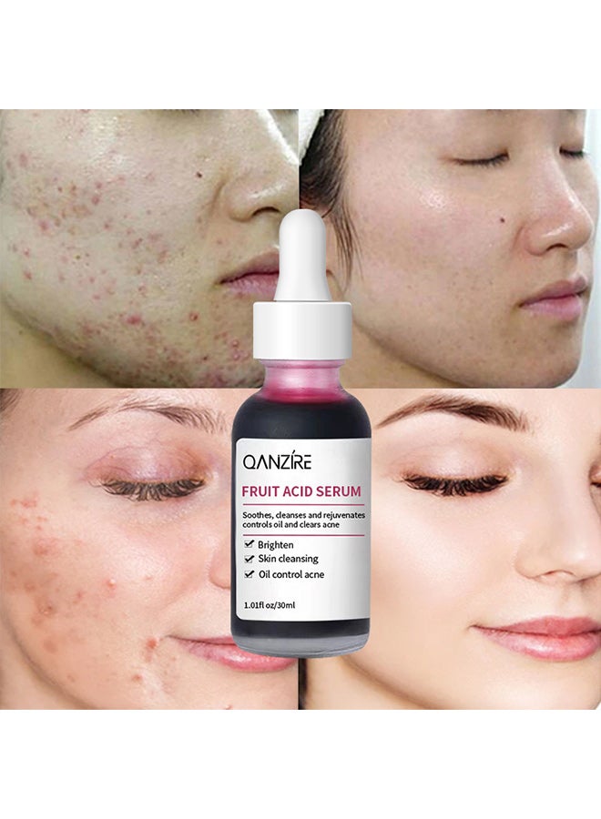 QANZIRE fruit acid essence, refines pores, cleanses skin, brightens skin tone, softens cuticles, and is a skincare product - Image 3