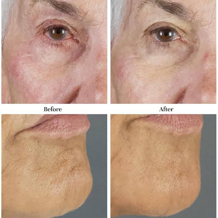 City Beauty MicroBiome Night Mask - Nourishing Overnight Face Mask - Prebiotic & Probiotic Blend - Solution for Dull, Uneven Skin Tone, Large Pores, & Wrinkles - Anti-Aging Cruelty-Free Skin Care - Image 2