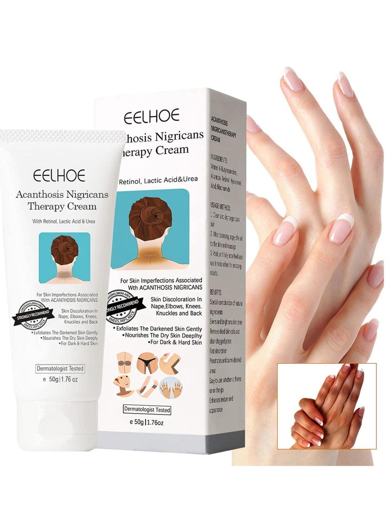 EELHOE كريم علاج الأكثينوزيس نيغريكانس، 50 جرام أكثينوزيس نيغريكانس مع حمض اللاكتيك، كريم ريتينول، كريم سيروم مصحح للبقع الداكنة - Image 1