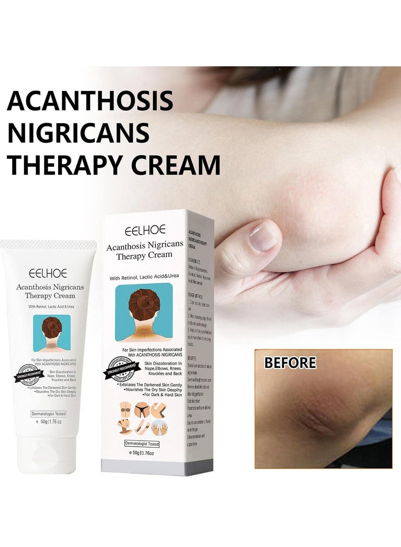 EELHOE كريم علاج الأكثينوزيس نيغريكانس، 50 جرام أكثينوزيس نيغريكانس مع حمض اللاكتيك، كريم ريتينول، كريم سيروم مصحح للبقع الداكنة - Image 3