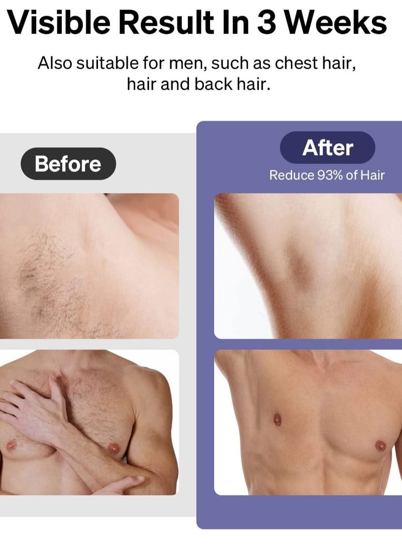 Ulike - Ulike AIR 3 IPL Hair Removal Handset with Sapphire Ice-Cooling System Purple - Image 1