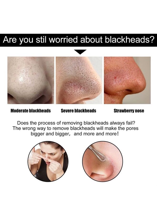 Mroobest Blackhead Pore Strips, Nose Strips for Blackheads, Nose Strips,Charcoal Nose Strips, Deep Cleansing Nose Area and Face Oil and Blackheads, for Women ＆ Men, 20PCS - Image 3