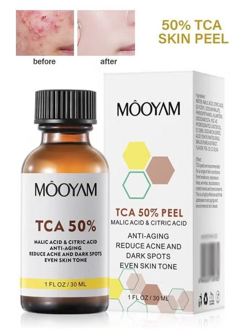 MOOYAM TCA 50% Peel Solution, With Malic Acid & Citric Acid Peeling Serum, Ultimate Chemical Exfolianting Facial Peel for Dark Skin, Dark Spots, Acne, Wrinkle, 30ML - Image 1