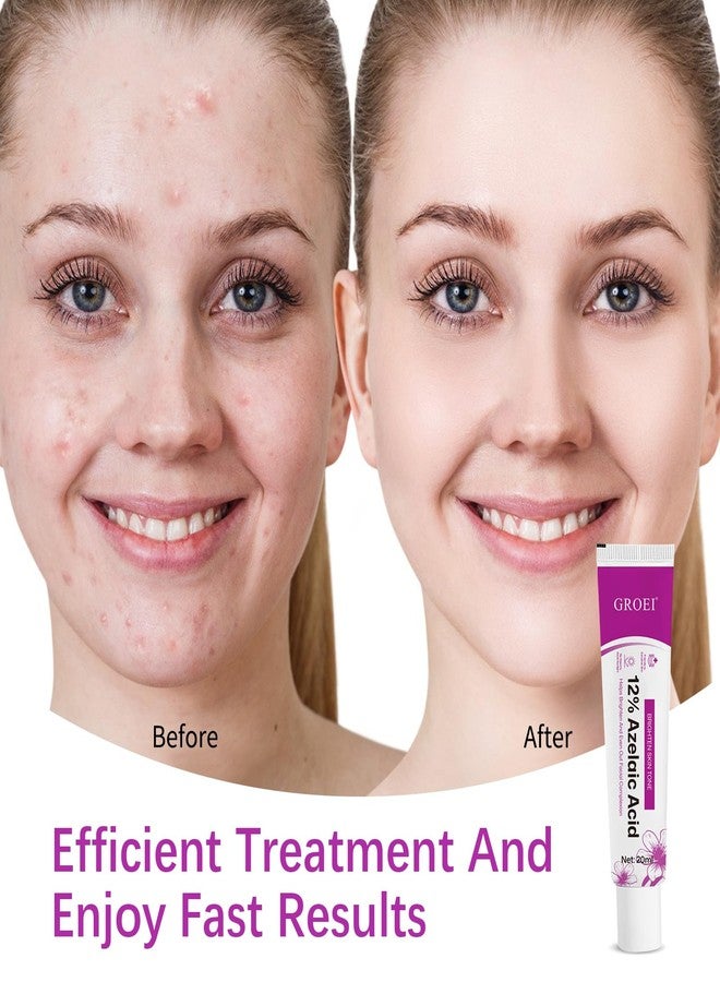 YILEST Azelaic Acid 12% Serum with Niacinamide & Hyaluronic Acid - Helps Improve Skin Texture, Reduce Redness, Smoothing Skin and Blemish, Premium Azelaic Acid Facial Cream for Sensitive Skin (1PC - Image 2