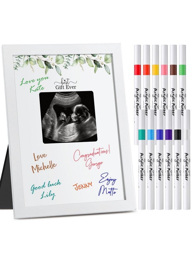 Maitys Ultrasound Picture Frame Baby Shower Sonogram Picture Frame Baby Shower Sign in Guest Book Alternatives Gender Reveal Pregnancy Keepsake Gift for Expecting Parents with 12 Acrylic Markers - Image 1