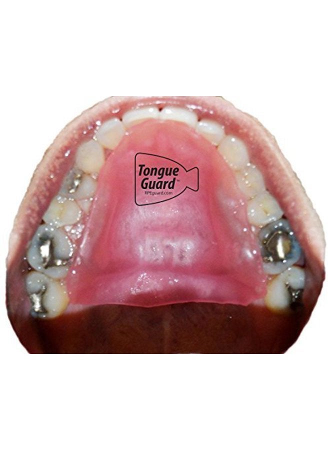 InvigoFlex حارس اللسان RPE: يمنع ويساعد في شفاء تقرحات اللسان الناتجة عن موسعات الأسنان - Image 2