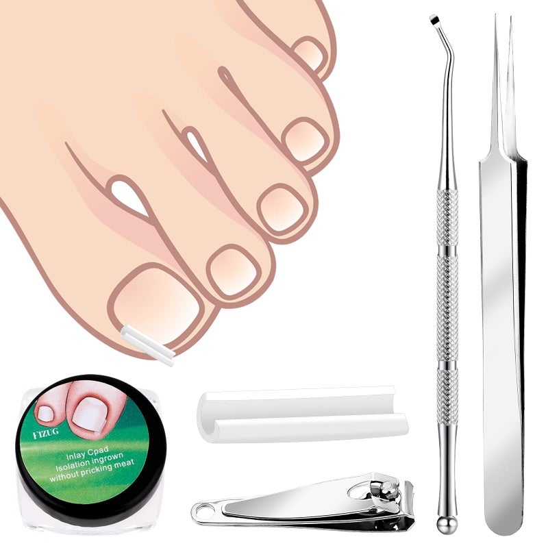 مجموعة علاج الأظافر المنغرسة من جيفداد 60 قطعة شرائط تصحيح الأظافر المنغرسة مع رافع الأظافر وقص الأظافر أدوات إزالة الأظافر المنغرسة سهلة الاستخدام