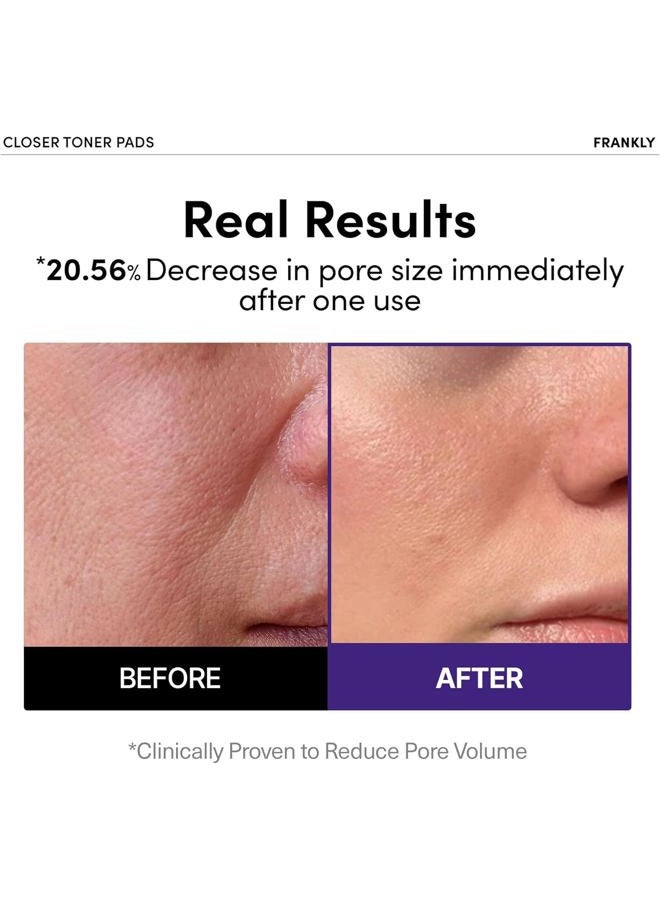 FRANKLY Pore Closer Toner Pads l Rice Jelly Pads with 9 Peptides, Vegan Collagen, Rice Extract l Pore Minimizer l Hydrating for All skin types l Korean Skin Care | 70 Count - Image 2