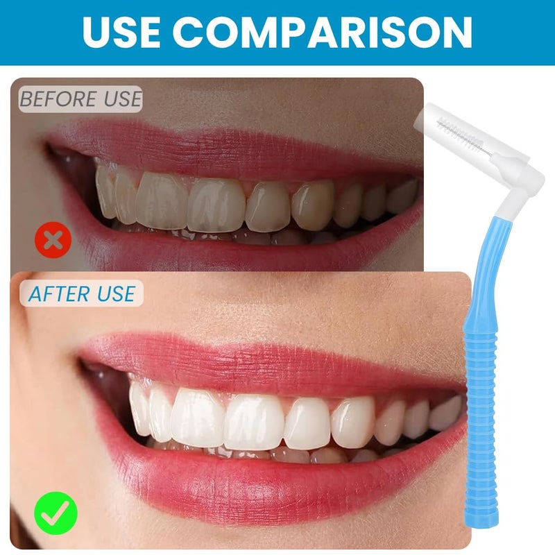 ZIBUYU® Angled Reusable Braces Dental Brush Flosser Interdental Toothpick Brush 25PCS Pack (15 Brushes + 10 Replacement Heads, 0.9mm Blue) for Braces, Implants, Crowns, Gaps & Oral Cleaning - Image 4