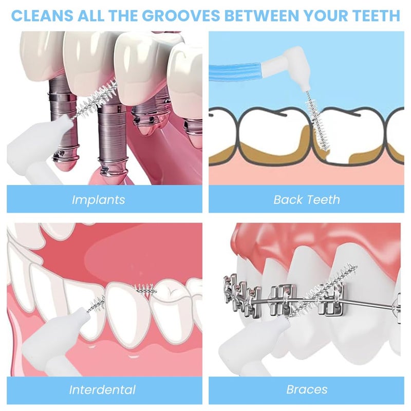 ZIBUYU® Angled Reusable Braces Dental Brush Flosser Interdental Toothpick Brush 25PCS Pack (15 Brushes + 10 Replacement Heads, 0.9mm Blue) for Braces, Implants, Crowns, Gaps & Oral Cleaning - Image 5