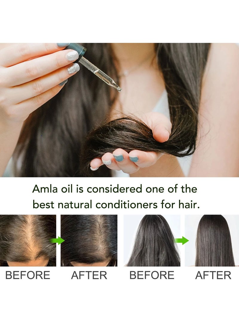 ALIVER - 60 ml Amla Oil 2.02 Fl Oz 100% Pure Natural Organic Amla Hair Oil Cold Pressed Amla Oil for Hair Growth Moisturize Healthy and Strengthen Hair Nourishes Scalp Hair Treatment Oil - Image 1