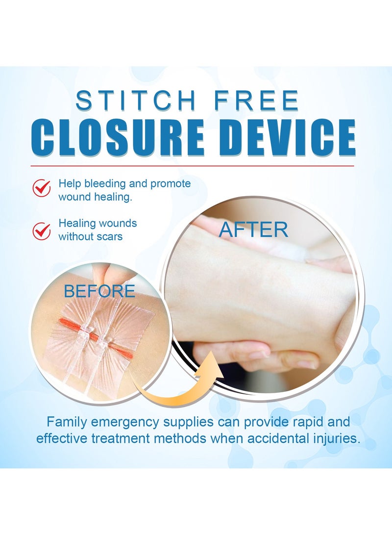 South Moon No-Suture Closure Band-Aid Skin Wound Care Band-Aid No-Suture - Image 3