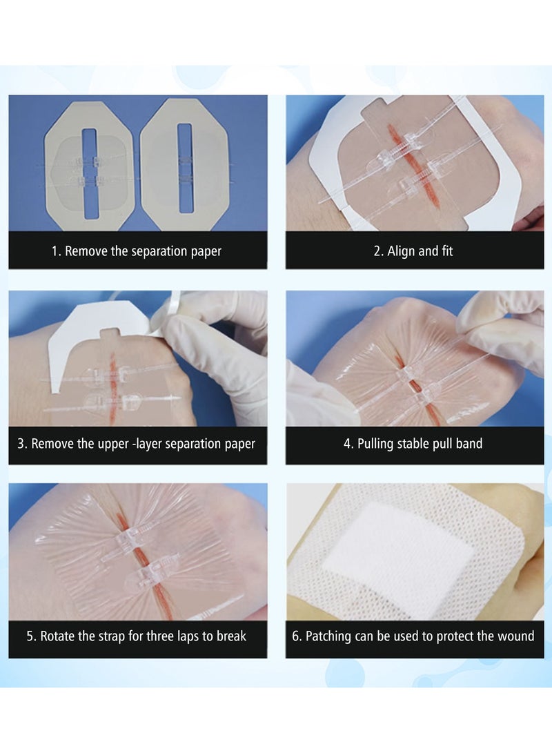 South Moon No-Suture Closure Band-Aid Skin Wound Care Band-Aid No-Suture - Image 5