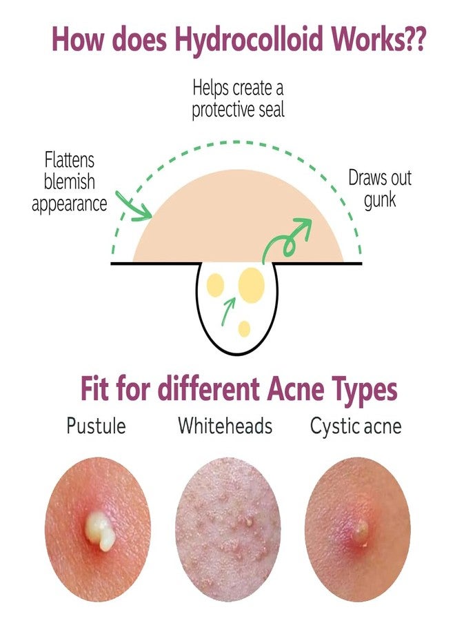 Floren Overnight Wonder Pimple Patch | Thicker Hydrocolloid Acne Patch | More effective & extra adhesion for better results | Facial stickers | Facial South Korean skin care | Drug-Free | 56 ct (Pack of 1) - Image 4