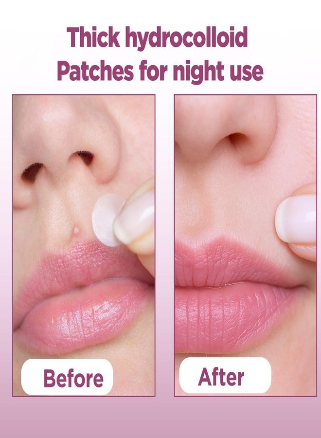 Floren Overnight Wonder Pimple Patch | Thicker Hydrocolloid Acne Patch | More effective & extra adhesion for better results | Facial stickers | Facial South Korean skin care | Drug-Free | 56 ct (Pack of 1) - Image 5
