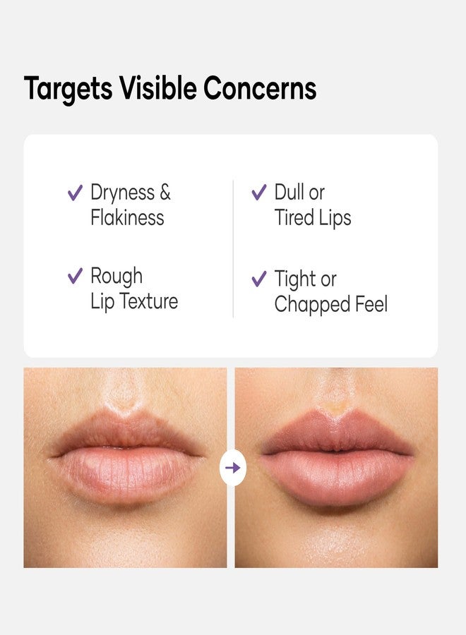 Cureskin قناع الشفاه كيورسكين للعناية العميقة بالشفاه | علاج مرطب للشفاه بفيتامين سي وزبدة الشيا لشفاه ناعمة ومرطبة | إصلاح ليلي | بلسم للشفاه الجافة والمتشققة | ترطيب يدوم طويلاً، 10 غرام (عبوة واحدة) - Image 5