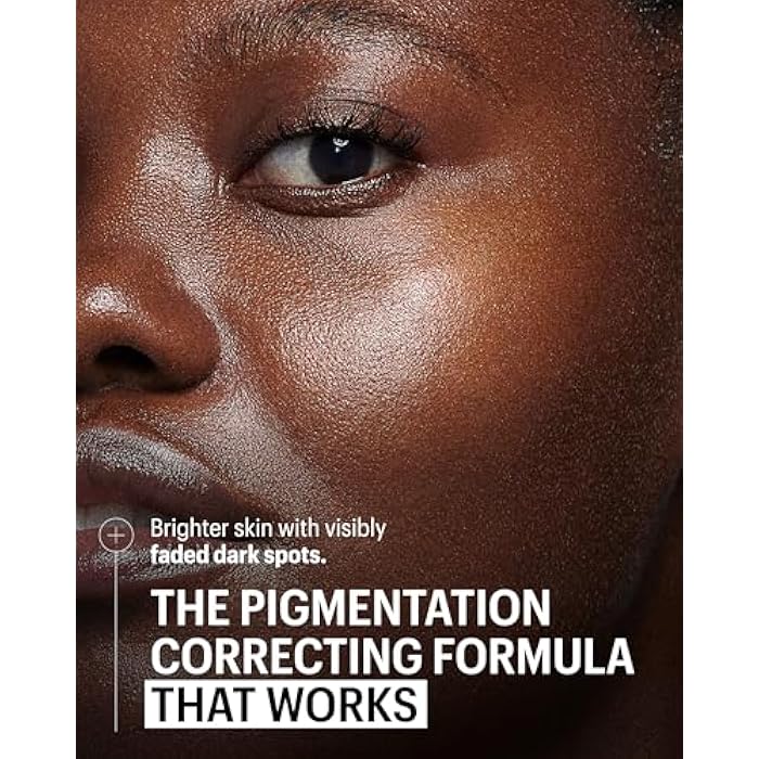 Allies of Skin Mandelic Pigmentation Corrector Night Serum | Gentle Acne Face Serum with Bakuchiol, Niacinamide & Salicylic Acid | Anti-Aging Formula to Reduce Pores and Even Skin Tone (1 oz) - Image 2