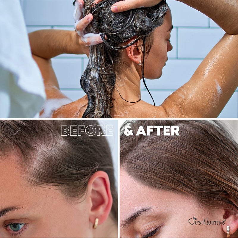 Just Nutritive Hair Loss Shampoo | Hair Regrowth Shampoo For Thinning Hair | Hair Growth Product For Men and Women | Just Nutritive | 16 Oz - Image 3
