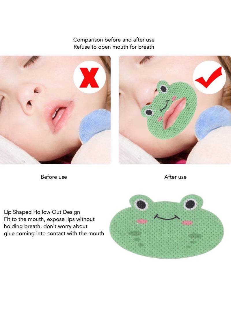 SYOSI 30 Pcs Sleep Strips for Kids Mouth Tape for Sleeping Anti Snoring Devices Kids Mouth Tape Reduce Snoring Avoid Mouth Breathing Improve Sleep Lip Patches for Loud Snoring Cartoon Frog  - Image 2