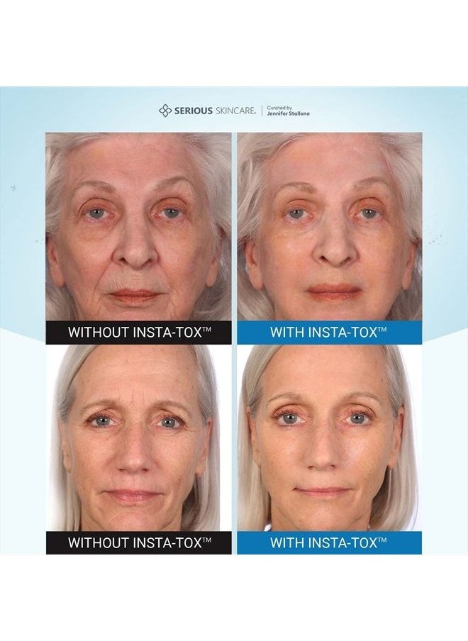 Serious Skincare - INSTA-TOX Instant Wrinkle Smoothing Serum - Improves appearance of Fine Lines & Wrinkles -Temporarily Tightens Skin - Instant Line Filler - Two .75 oz. Tubes (2Pack) - Image 1