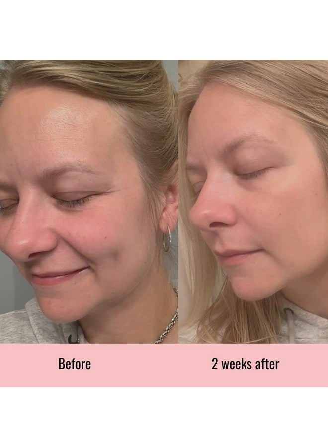 2 See Transformation Skincare Vitamin C Serum Hyaluronic Acid Serum For Face Anti Aging Menopause Support Skin Care Products Smooth & Tightening Skincare Dark Spot Remover_2 See Transformation Skincare 1 Oz - Image 4