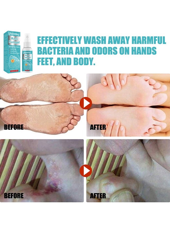 Jaysuing - Anti Fungal Athletes Foot Treatment Spray, Prevent Athlete's Foot,Smelly Feet,Relieve Itching of Feet, Sweating, Peeling And Blisters, Natural Ingredients Foot Fungi Spray For Tinea Pedis 50ML - Image 1
