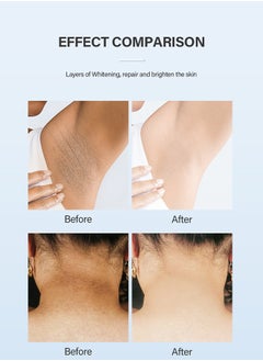 MOOYAM Whitening Cream With Retinol Lactic Acid  ,Dermatologist Tested,Hyperpigmentation Removal Cream For Dark Body Parts like Neck Ankles Knuckles Armpits 50g  - Image 4