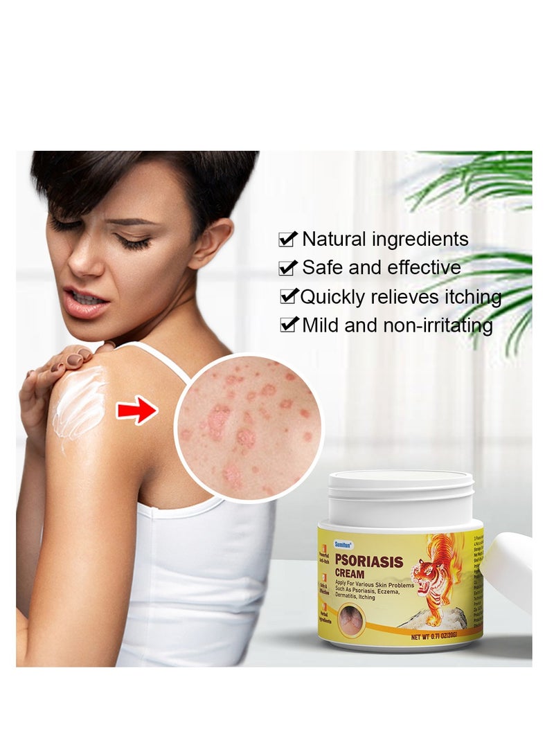 سوميفون كريم الصدفية لعلاج الصدفية كريم الأكزيما المضاد للبكتيريا التهاب الجلد المضاد للحكة ، 3 قطع - Image 3