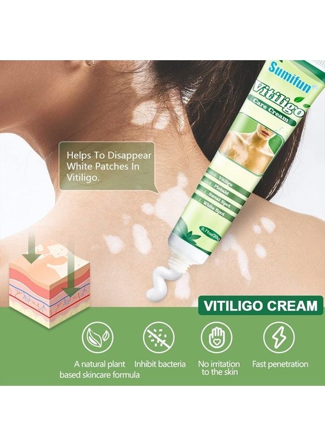 Sumifun - Vitiligo Cream, Vitiligo Care Cream for Skin Vitiligo, Psoriasis, Leukoplakia - Reduces White Spots on Skin, Pigmentation regulating and Improve Skin Pigmentation - 6 Counts - Image 1