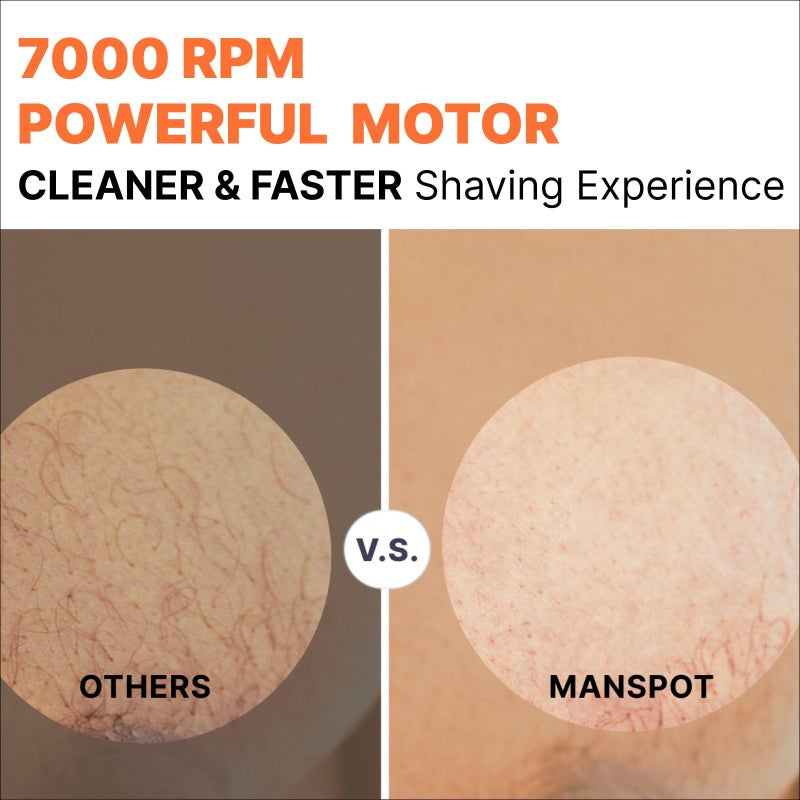 MANSPOT Manscape Groin & Body Hair Trimmer for Men, Electric Ball Trimmer Pubic Trimmer Shaver,Manscape Kit with 4 Guard,Replaceable Ceramic Blade Heads,Waterproof Wet/Dry Shaver,90 Minutes Shaving - Image 4