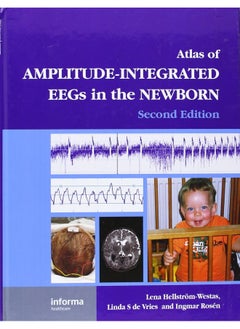 An Atlas of Amplitude-Integrated EEGs in the Newborn 