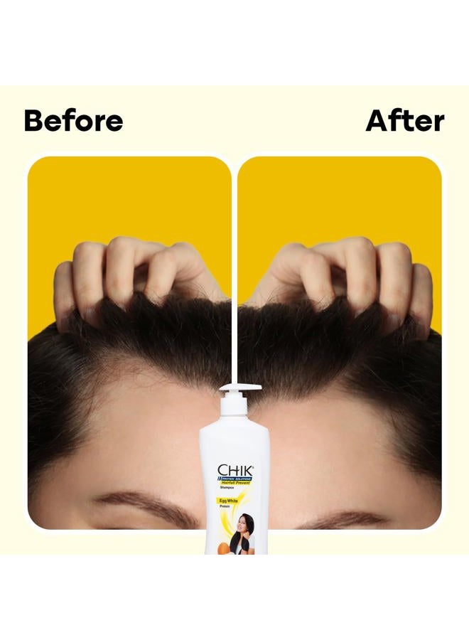 Chik Hairfall Prevent Egg Shampoo, 340ml - Image 5