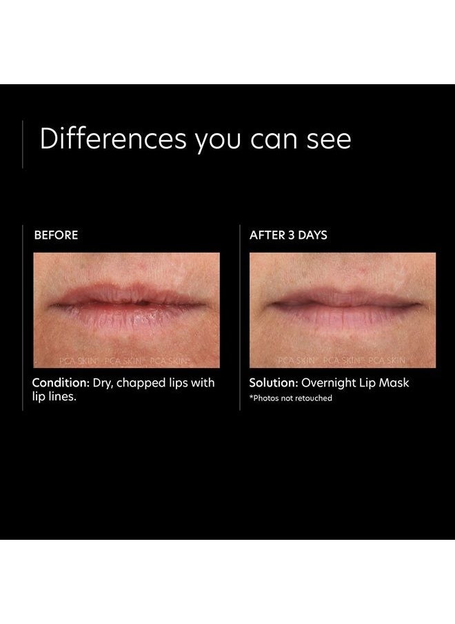 PCA SKIN Overnight Lip Balm Mask — Ultra-Moisturizing Lip Skin Care Treatment, Restores Moisture & Hydrates Dry, Chapped Lips while Sleeping (0.46 oz) 