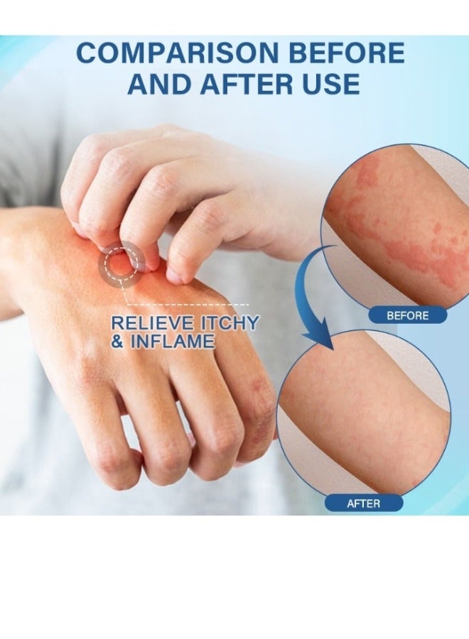 سوميفون كريم العناية بالحساسية للبشرة، للحساسية، الحكة، احمرار البشرة والتورم، 20 غرام - Image 2